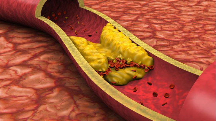 Alimentul care poate scădea colesterolul, dar pe care cu siguranță nu-l mănânci