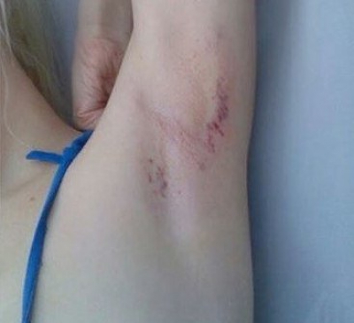 Tot internetul râde de ele. Au vrut să "se facă frumoase" cu bani puţini!