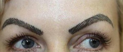 Tot internetul râde de ele. Au vrut să "se facă frumoase" cu bani puţini!