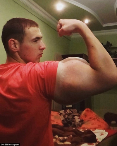 Imagini HALUCINANTE cu un rus dependent de steroizi: ”Pot să mor...”