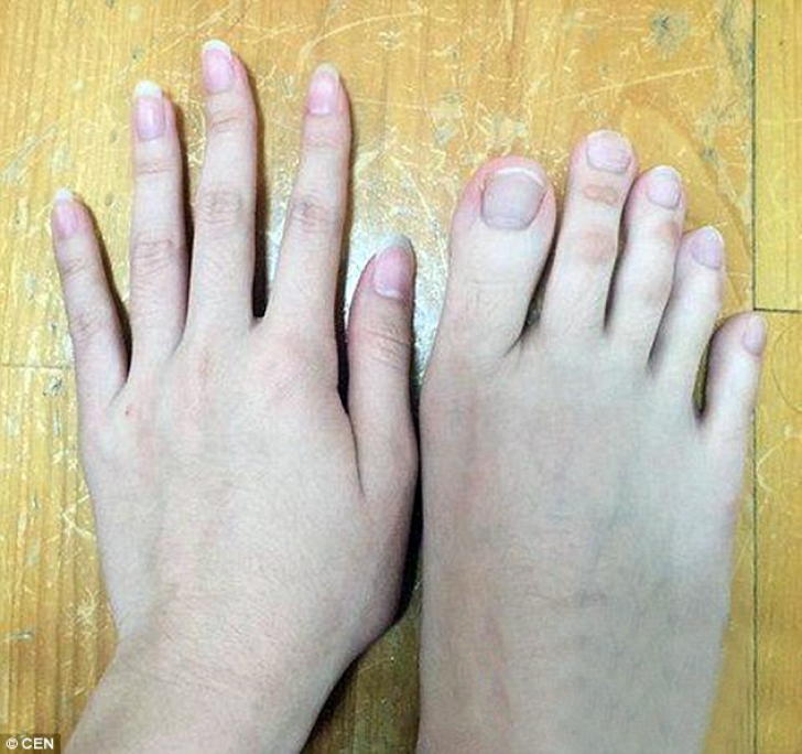 Mâini sau picioare? Imaginea acesta a revoltat internetul: Nu este posibil!