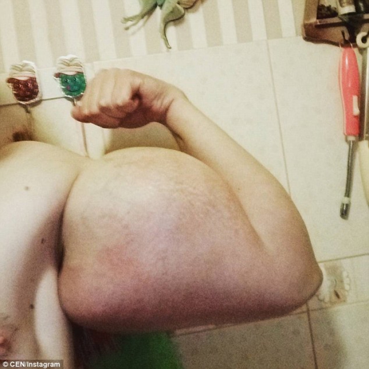 Imagini HALUCINANTE cu un rus dependent de steroizi: ”Pot să mor...”