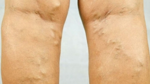 Durerea articulara persista