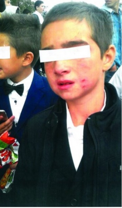 Ce se întâmplă la o şcoală din România. Copiii, bătuţi şi zgâriaţi de directoare - FOTO