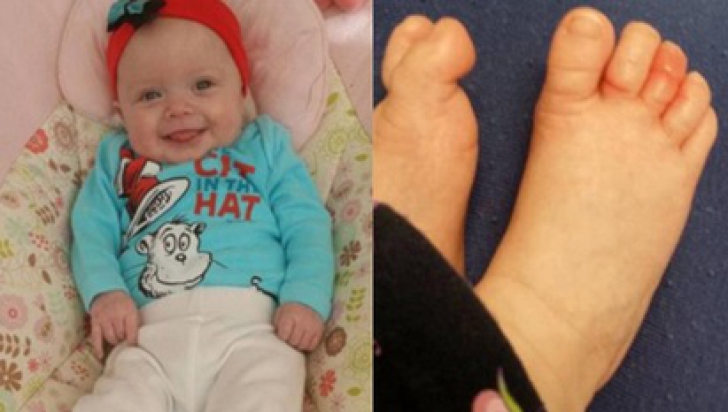 Piciorul bebeluşului era roşu şi umflat. Când s-a uitat la un deget, a îngheţat de spaimă! Acolo...