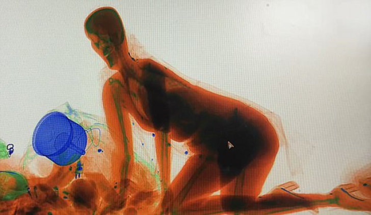Gestul extrem de riscant al unei femei: a intrat prin scanerul cu raze X 