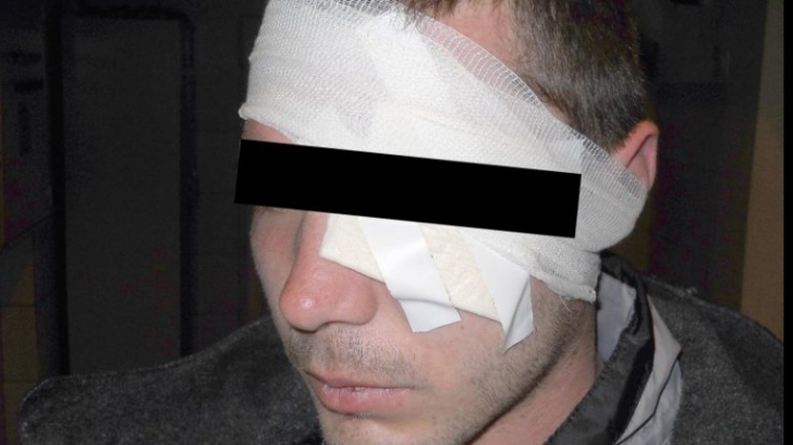 Cazul bizar al tânărului din Cluj bătut crunt de doi bărbaţi, la îndemnul fostei iubite 