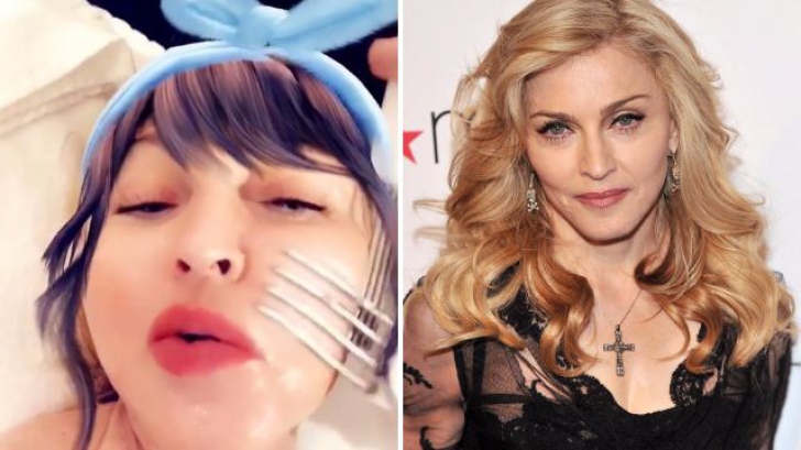 Tratamentul bizar pe care Madonna îl aplică tenului cu furculița pentru a rămâne tânără