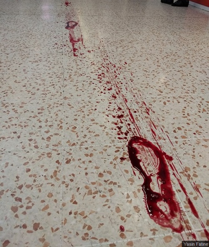 Doctorul a luat urma petelor de sânge din mall. Ce a descoperit ACOLO l-a marcat pe viaţă!