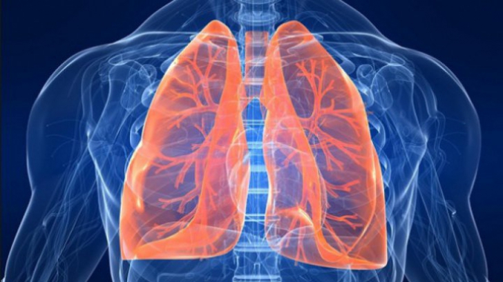 Veste uriaşă pentru bolnavii cu cancerul pulmonar: Un nou tratament are rezultate excelente