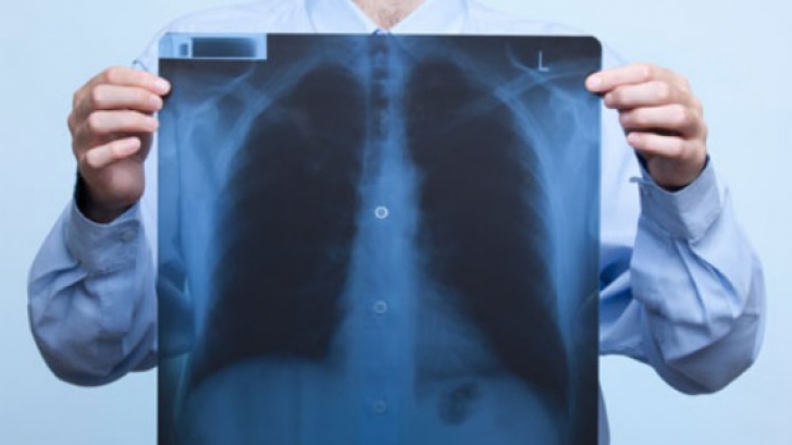 Edemul pulmonar - simptome, diagnostic şi tratament