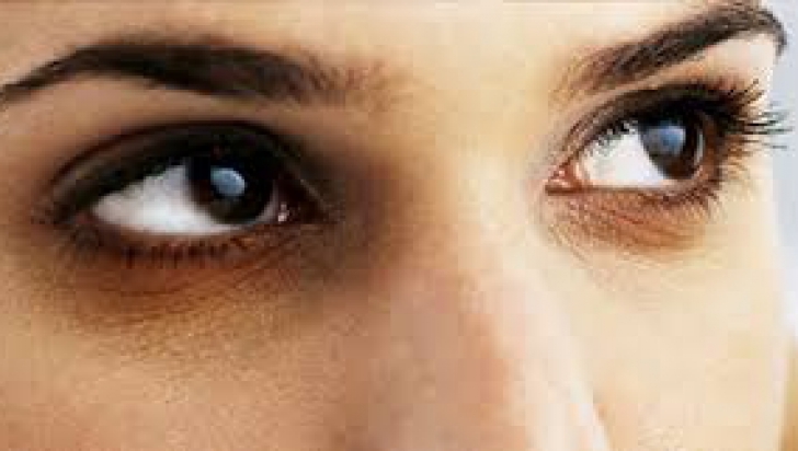 Evaluarea concesionarilor din cercurile întunecate sub ochi: bun și cel mai bun - Vitamine 