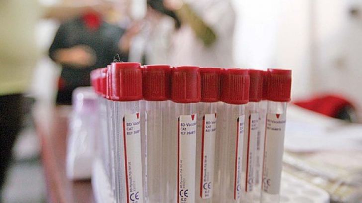 Ministerul Sănătăţii: 1.000 de doze de imunoglobulină au ajuns în România