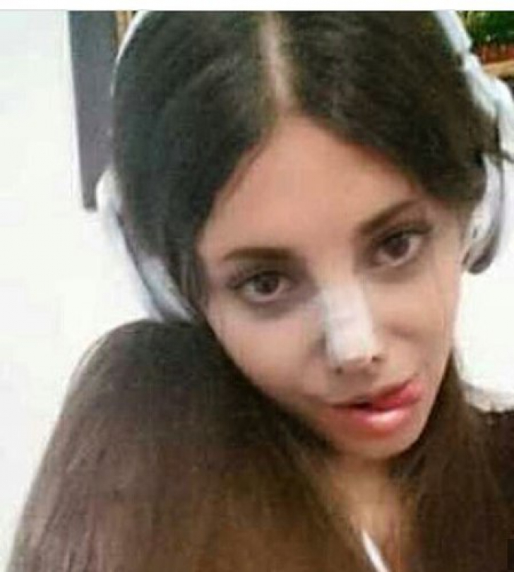 Tânăra care a făcut zeci de operaţii estetice ca să arate ca Angelina Jolie. Rezultatul e teribil