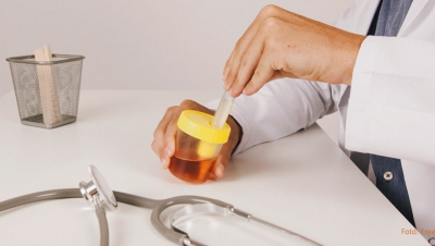 Culoarea urinei îți poate indica dacă ai o infecție urinară sau cancer 
