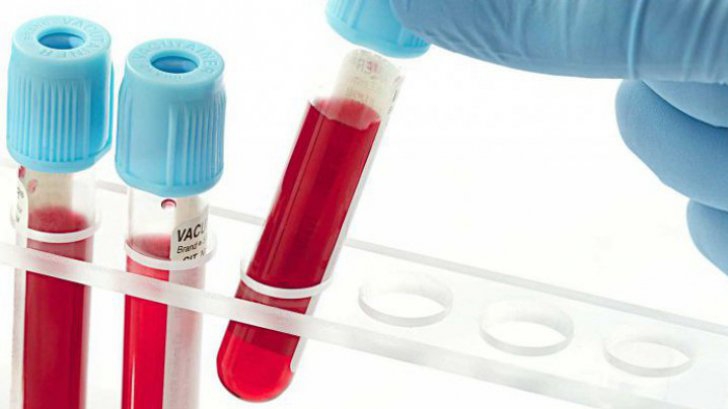   The blood type shows you if you are getting cancer. Who has the highest risk? 