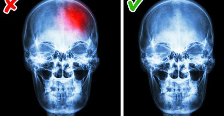 Adormi greu, deşi eşti extrem de obosit? Poţi suferi de o boală foarte gravă. Medicii atrag atenţia! Adormi greu, deşi eşti extrem de obosit? Poţi suferi de o boală foarte gravă. Medicii atrag atenţia!