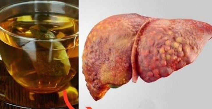 Avertismentul medicilor: acest ceai te poate îmbolnăvi de hepatită!