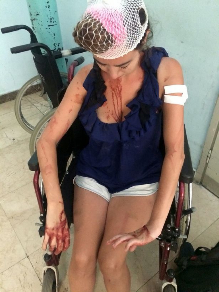 A fost bătută până la sânge pentru că a refuzat să plătească bani în plus la cazare