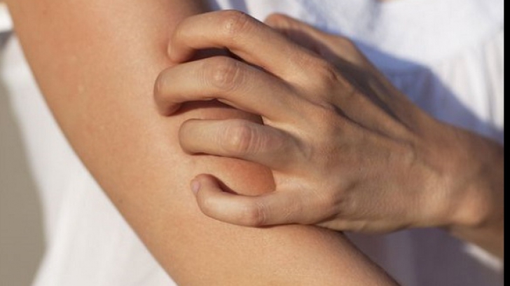 Ce boli poate anunța mâncărimea pielii