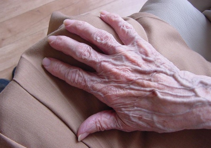 Mâinile sunt bolnave de artrită - ramonafabian.ro