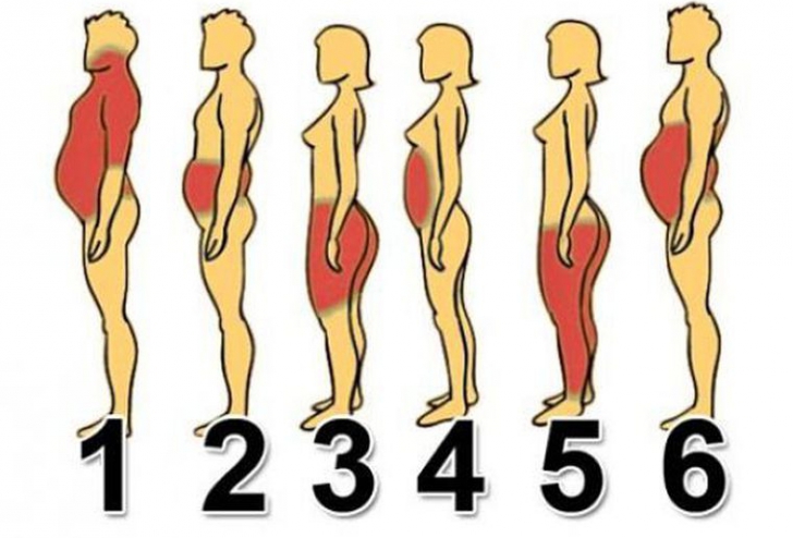 Cum slăbești în funcție de forma corpului și de locul unde se depozitează grăsimea