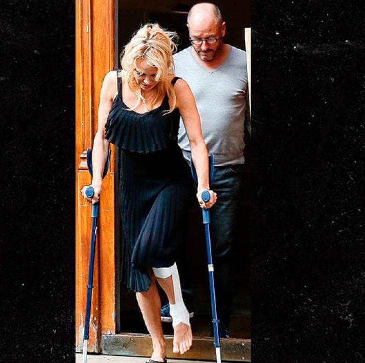 Pamela Anderson,  în cârje, după accidentarea suferită