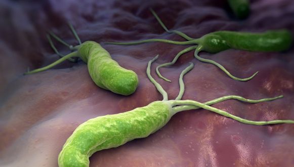 Helicobacter pylori, bacteria comună ce afectează stomacul