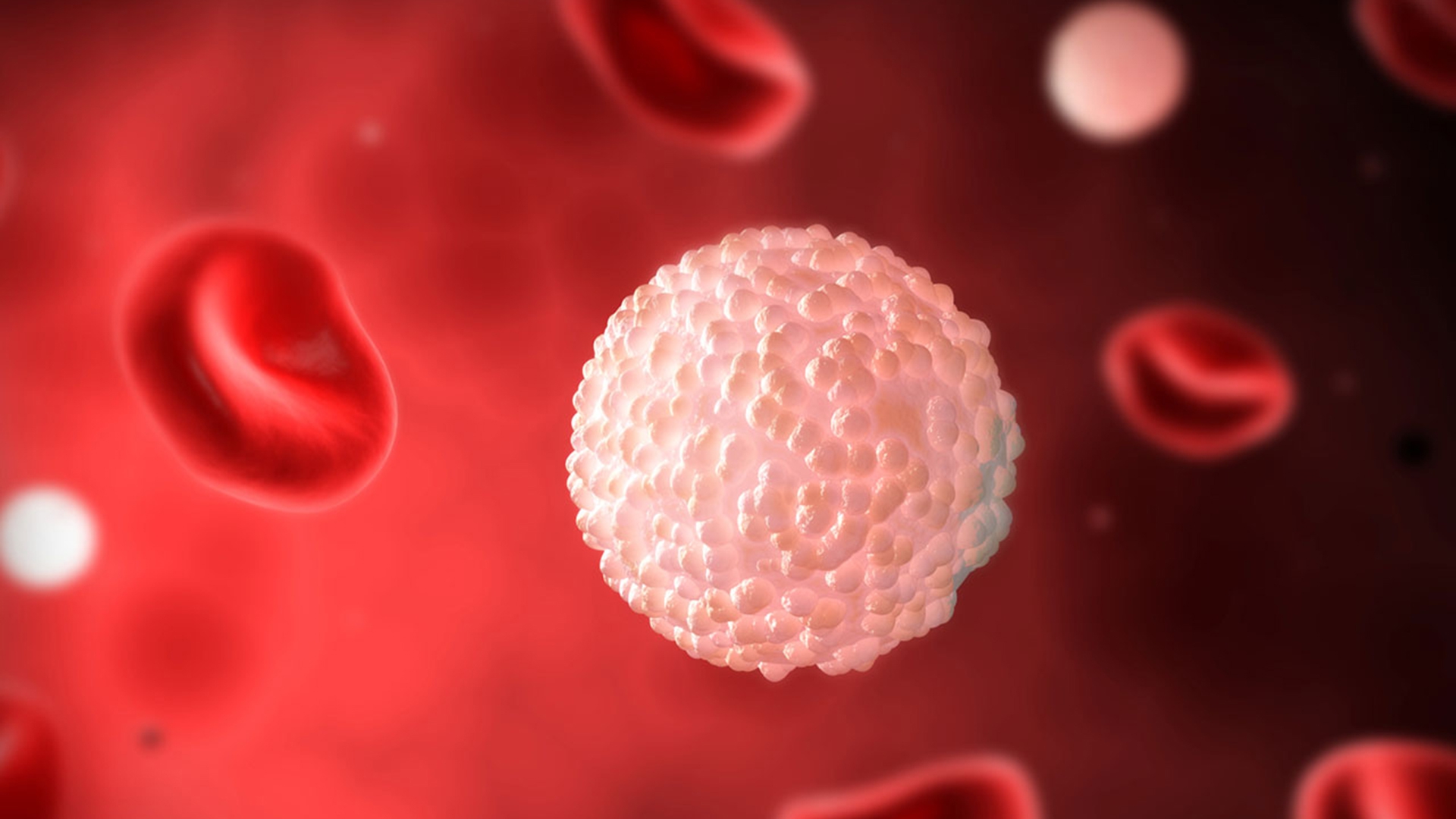 Ce este septicemia?