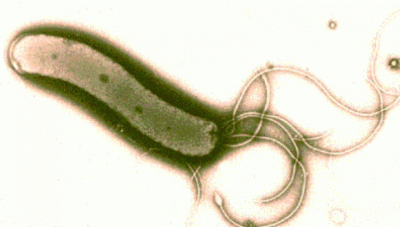 Leguma care omoară bacteria helicobacter pilori, cea care cauzează ulcerele
