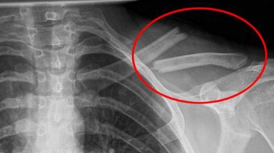 Consumi această otravă în fiecare zi, fără să ştii cât de rău îţi face
