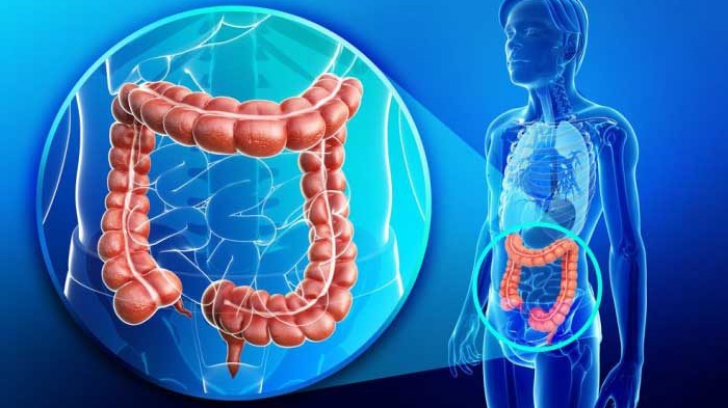 Întrebări frecvente în bolile inflamatorii intestinale - Studii Clinice