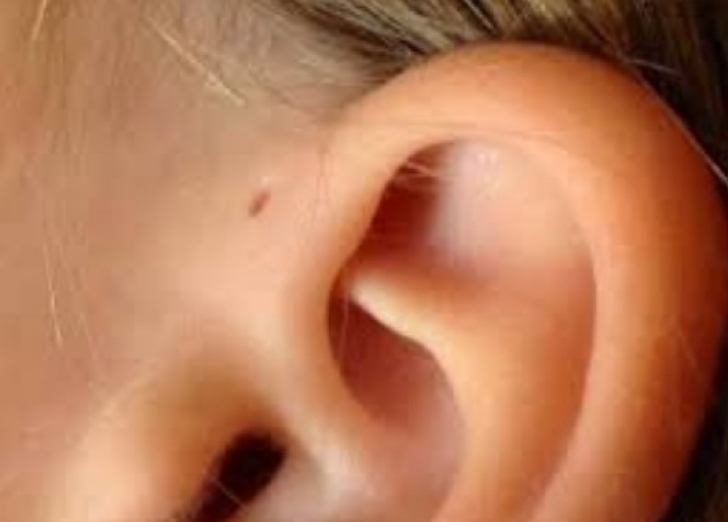 Misterul oamenilor care se nasc cu o gaură pe ureche. Semnul care bulversează lumea ştiinţifică