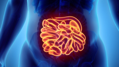 Cancerul de intestin subtire: simptome si cauze