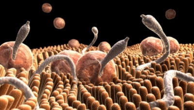 Mare atenție! Acestea sunt simptomele infecţiei cu paraziţi intestinali