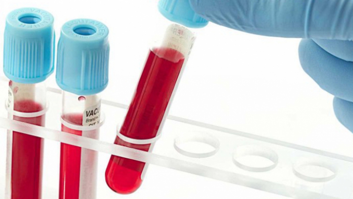 Grupa de sânge îți arată dacă vei face cancer. Cine are cel mai mare risc?