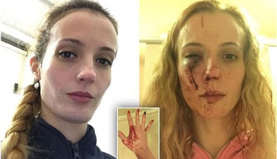 Anca, o tânără din România, atacată violent în Marea Britanie