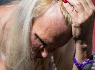 A cheltuit o avere pentru a arăta "perfect". AŞA este azi. Cum arăta &Icirc;NAINTE? Te trec fiorii...