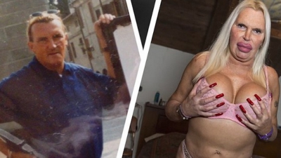 A cheltuit o avere pentru a arăta "perfect". AŞA este azi. Cum arăta &Icirc;NAINTE? Te trec fiorii...