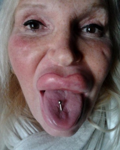 A cheltuit o avere pentru a arăta "perfect". AŞA este azi. Cum arăta &Icirc;NAINTE? Te trec fiorii...