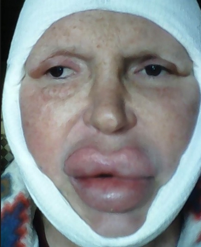 A cheltuit o avere pentru a arăta "perfect". AŞA este azi. Cum arăta &Icirc;NAINTE? Te trec fiorii...