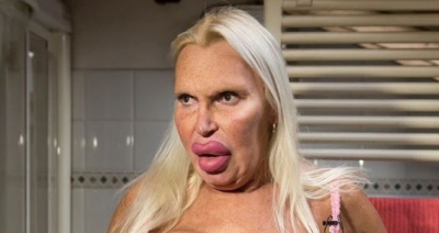 A cheltuit o avere pentru a arăta "perfect". AŞA este azi. Cum arăta &Icirc;NAINTE? Te trec fiorii...