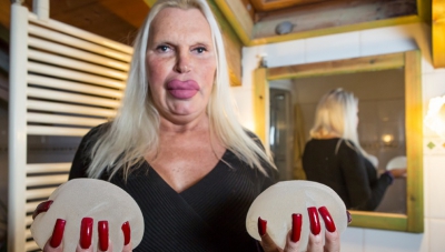 A cheltuit o avere pentru a arăta "perfect". AŞA este azi. Cum arăta &Icirc;NAINTE? Te trec fiorii...