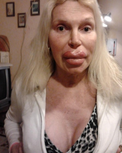 A cheltuit o avere pentru a arăta "perfect". AŞA este azi. Cum arăta &Icirc;NAINTE? Te trec fiorii...