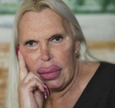 A cheltuit o avere pentru a arăta "perfect". AŞA este azi. Cum arăta &Icirc;NAINTE? Te trec fiorii...