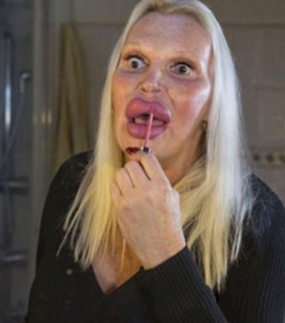 A cheltuit o avere pentru a arăta "perfect". AŞA este azi. Cum arăta &Icirc;NAINTE? Te trec fiorii...