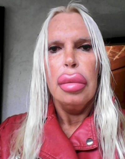 A cheltuit o avere pentru a arăta "perfect". AŞA este azi. Cum arăta &Icirc;NAINTE? Te trec fiorii...