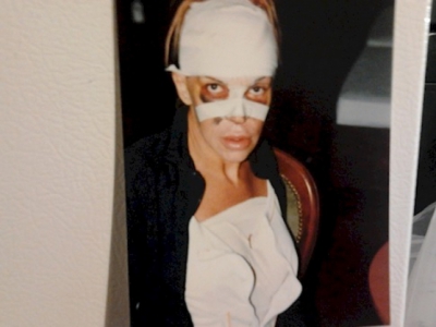 A cheltuit o avere pentru a arăta "perfect". AŞA este azi. Cum arăta &Icirc;NAINTE? Te trec fiorii...