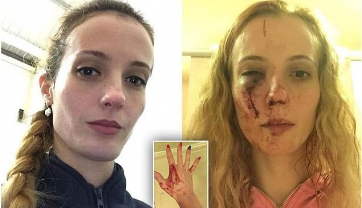 Anca, o tânără din România, atacată violent în Marea Britanie