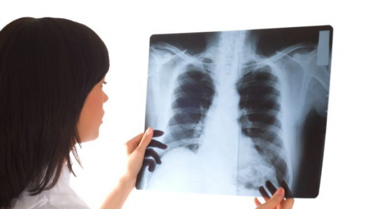 Scandalul radiografiilor de la Spitalul Slatina. Unele aparțineau altor medici
